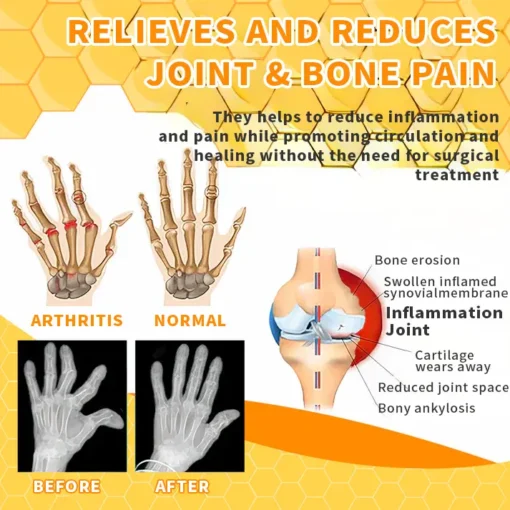 AQA™ Bee Essence Joint Therapy Pain Relief Gel