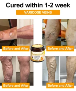 Bearnica™ Bee Venom & Turmeric Arthritis Therapy Cream