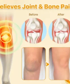 Bee Venom Cream™ for Nerve & Joint Pain Relief