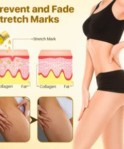 Biancat™ Stretch Marks Removal Oil