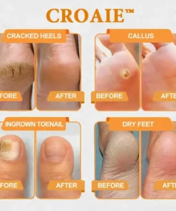 CROAIE™ Bee Venom & Herbal Slimming Foot Patches for Lymphatic Support and Blood Sugar Balance