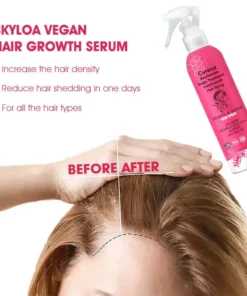 Cvreoz BeeVenom Scalp Treatment HairGrowth Hair Spray