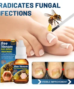 FLYCARE™ BeeVenom Nail Repair Treatment