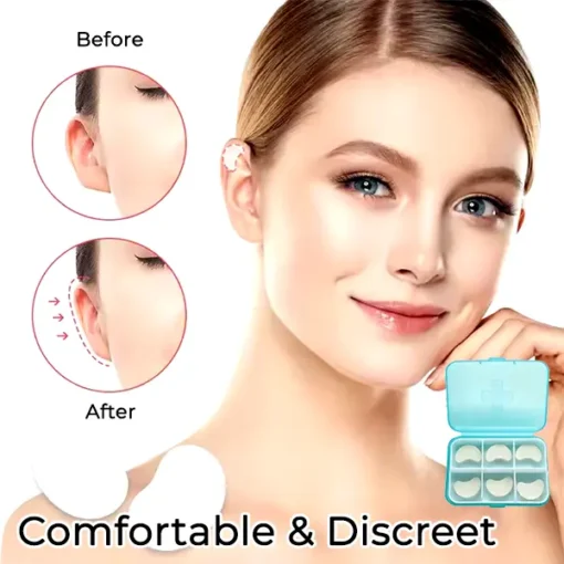 Fivfivgo™ Cosmetic Ear Corrector