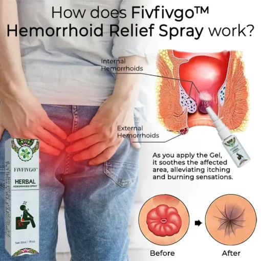 Fivfivgo™ Hemorrhoid Relief Spray