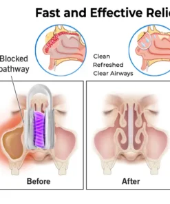 Fivfivgo™ Nasal Mucus Cleaning Device