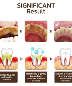 Fivfivgo™ Niacinamide Whitening Toothpaste