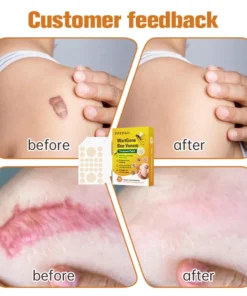 Fivfivgo™ WartGone Bee Venom Treatment Patch