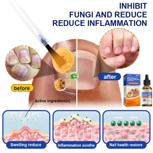 Furzero™ Bee Venom Nail Fungus Treatment Solution