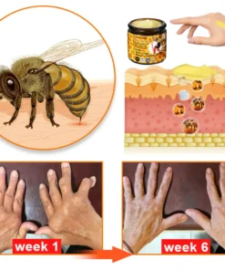 HONXI™ BEE VENOM Supreme Bone PainRelief joint Cream