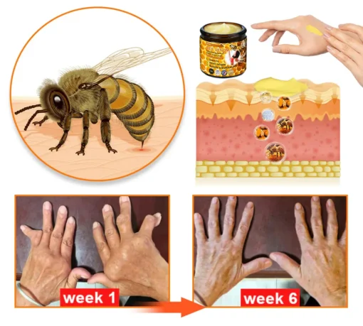 HONXI™ BEE VENOM Supreme Bone PainRelief joint Cream