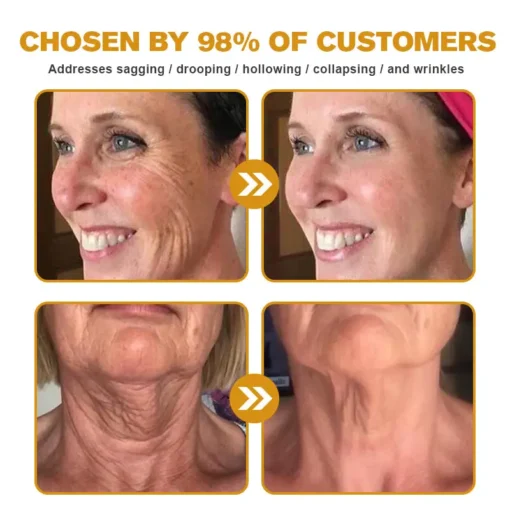 LOVILDS™ Botox Wrinkle Removal Cream