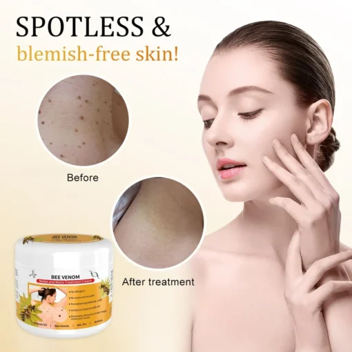 LOVILDS™Bee Venom Mole and Wart Treatment Cream