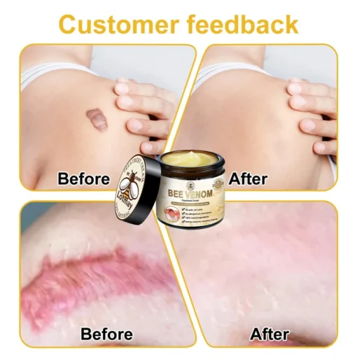 Lotmay™ Bee Venom Skin Treatment Cream