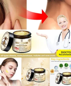 Lotmay™ Bee Venom Skin Treatment Cream