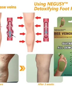 NEGUSY™ LymphTox Bee Venom Slimming & Detox Foot Patches