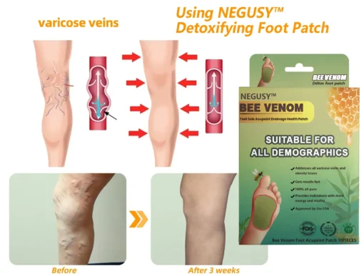 NEGUSY™ LymphTox Bee Venom Slimming & Detox Foot Patches