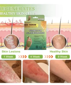 NEGUSY™ LymphTox Bee Venom Slimming & Detox Foot Patches