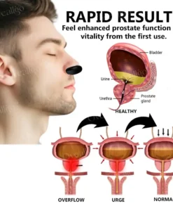 Oveallgo™ ProstaNasal Boost Portable Device