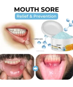 QIAWI ™ PearlySmile Bee Venom Oral Care Powder