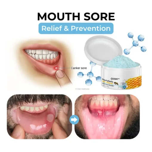 QIAWI ™ PearlySmile Bee Venom Oral Care Powder