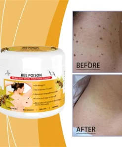 QIAWI™ BEE POSON MOLE AND WART TREATMENT CREAM