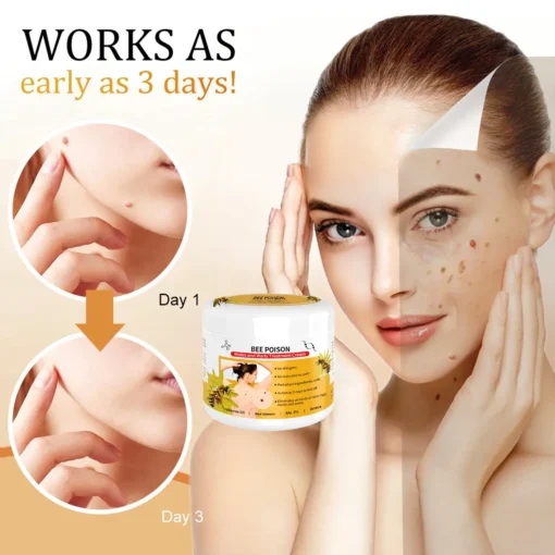 QIAWI™ BEE POSON MOLE AND WART TREATMENT CREAM