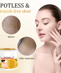 QIAWI™ BEE POSON MOLE AND WART TREATMENT CREAM