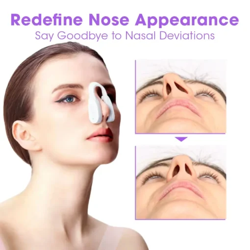 Qiawi™ NosaNova Nose Sculpting Device