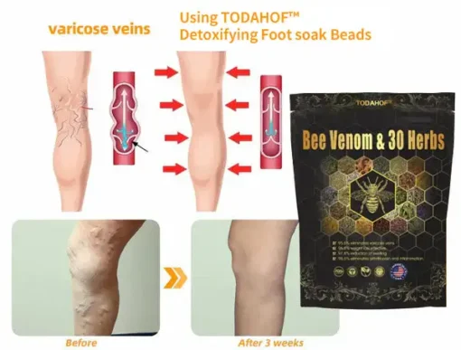 TODAHOF™ Bee Venom & 30-Herb Detox Foot Soak Beads