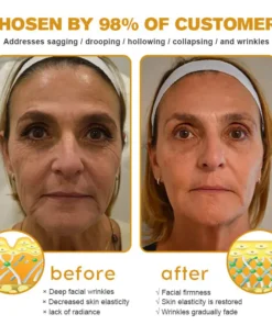 𝐒𝐩𝐳𝐯™ Botox Bee Venom Wrinkle Removal Cream