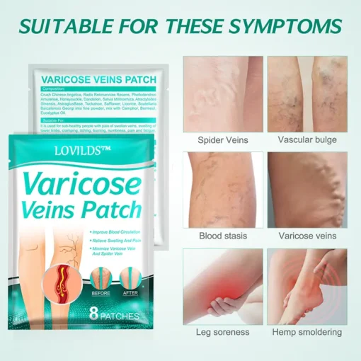 LOVILDS™ Leech Varicose Veins Patch