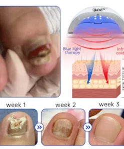 QIAWI™ PureNail Fungus Laser Device