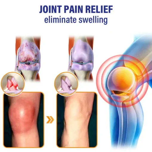 flysmus™ Lidocaine Joints Pain Relief Healing Liquid