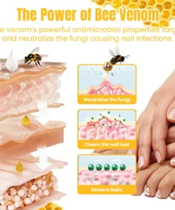 Ceoerty™ FungiGone Bee Venom Nail Cream