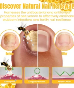 Ceoerty™ FungiGone Bee Venom Nail Cream