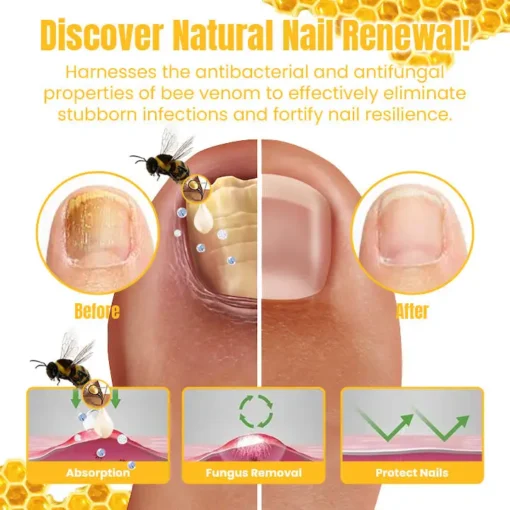 Ceoerty™ FungiGone Bee Venom Nail Cream