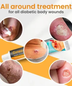 Cvreoz™ Diabetic Wounds Treatment Cream