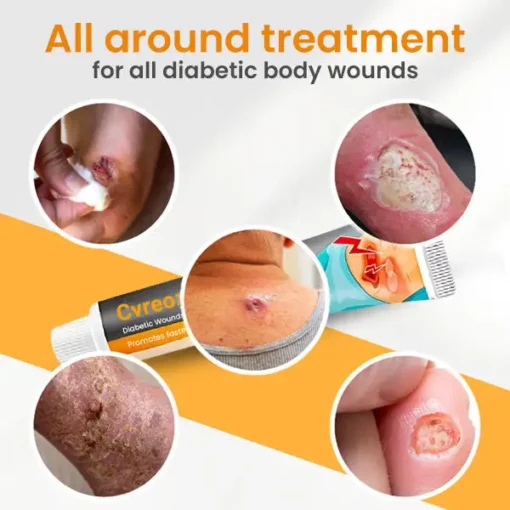 Cvreoz™ Diabetic Wounds Treatment Cream