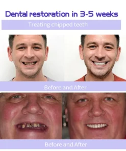 Cvreoz® Teeth Restoration Mineral Powder