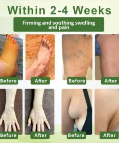 Fivfivgo™ SwellSoothe Lymphatic Cream