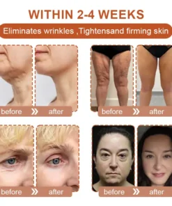 Flysmus™ BotoxBee Wrinkle Removal Cream