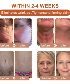 Flysmus™ BotoxBee Wrinkle Removal Cream